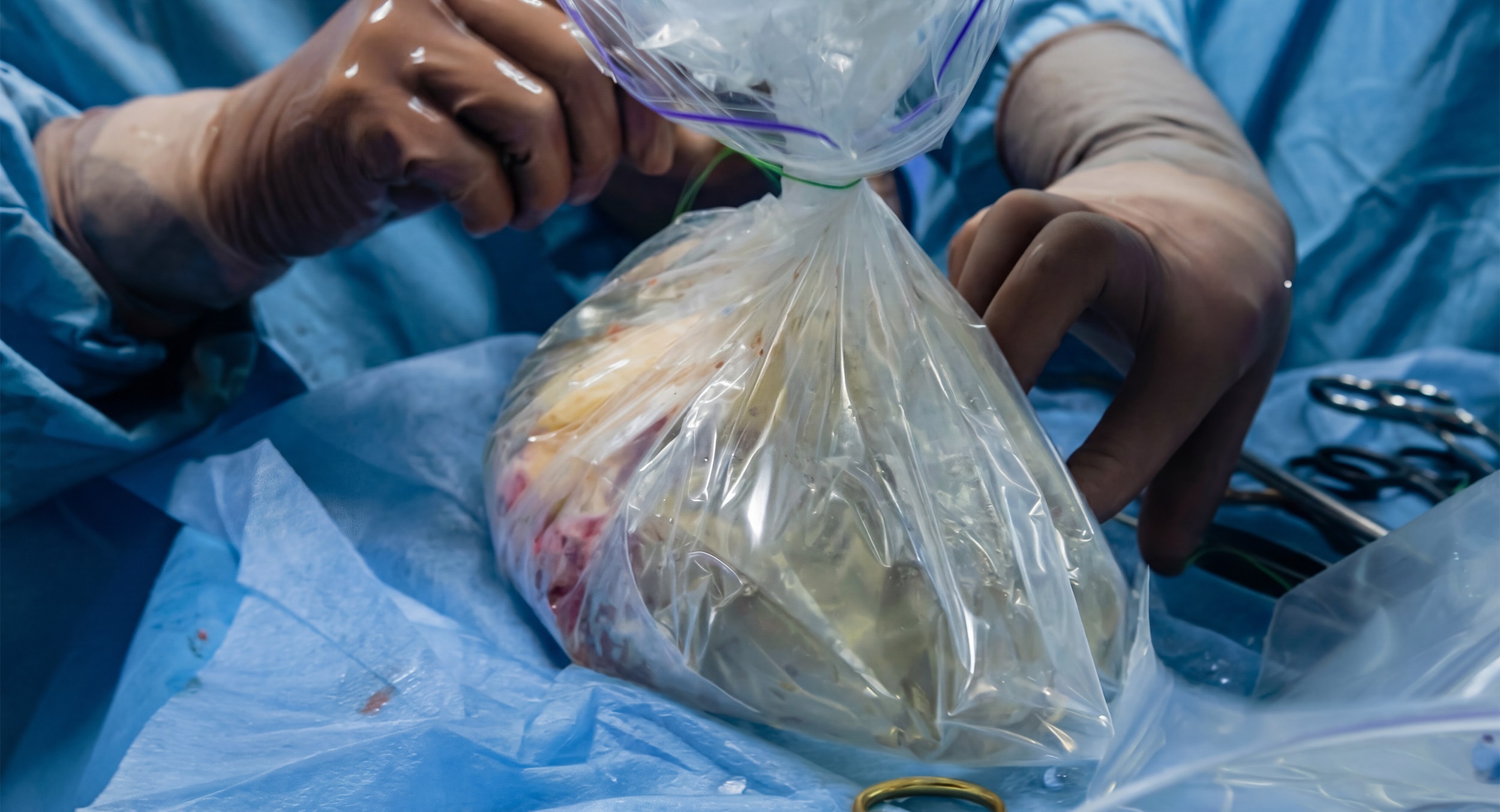 Transplantology